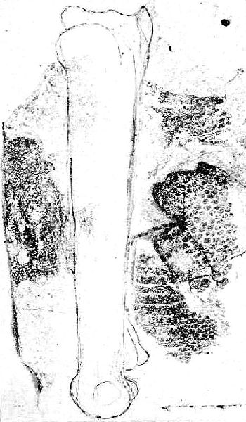 Williston1896Pl2.jpg (59100 bytes)