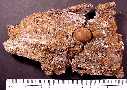 gastro3a.jpg (4066 bytes)
