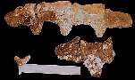 t-abdom.jpg (3780 bytes)