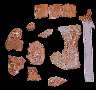 t-pelvic.jpg (2870 bytes)